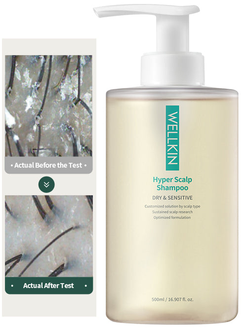 WELLKIN Hyper Scalp Shampoo 300ml / 500ml